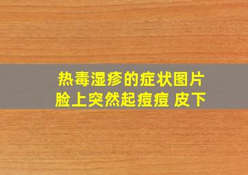 热毒湿疹的症状图片脸上突然起痘痘 皮下